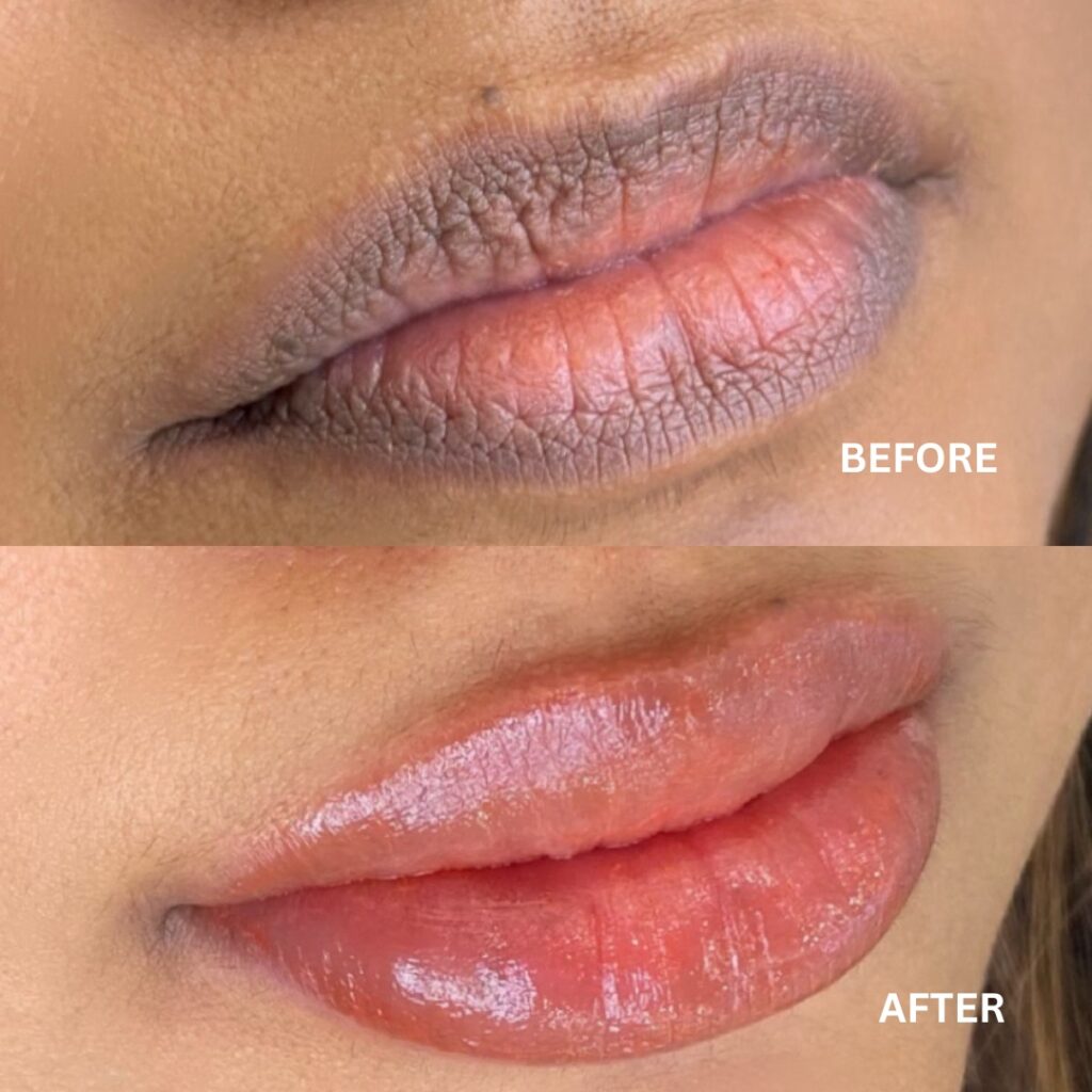 lip colouring Before & After